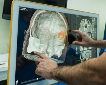 Prioridade para casos de AVC e infarto é foco de projeto